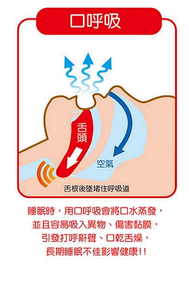 口呼吸示意圖